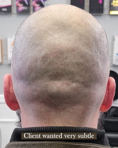 After scalp micropigmentation back view showing FUE scars camouflaged with even density and natural appearance in Jacksonville FL